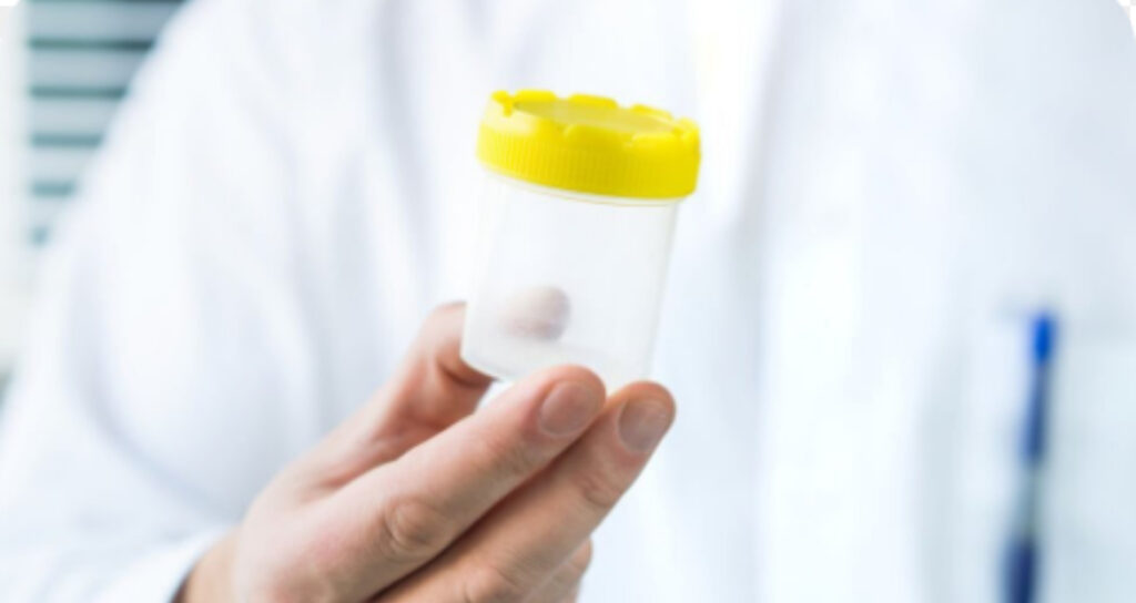 &Kappa;&alpha;&tau;&alpha;&gamma;&gamma;&epsilon;&lambda;ί&epsilon;&sigmaf; &gamma;&iota;&alpha; &lambda;ά&theta;&omicron;&sigmaf; &sigma;&pi;έ&rho;&mu;&alpha; &sigma;&epsilon; &kappa;&lambda;&iota;&nu;&iota;&kappa;ή &epsilon;&xi;&omega;&sigma;&omega;&mu;&alpha;&tau;&iota;&kappa;ή&sigmaf; &sigma;&tau;&alpha; &kappa;&alpha;&tau;&epsilon;&chi;ό&mu;&epsilon;&nu;&alpha; &ndash; &Sigma;&omicron;&beta;&alpha;&rho;ά &epsilon;&rho;&omega;&tau;ή&mu;&alpha;&tau;&alpha; &gamma;&iota;&alpha; &alpha;&mu;έ&lambda;&epsilon;&iota;&alpha;